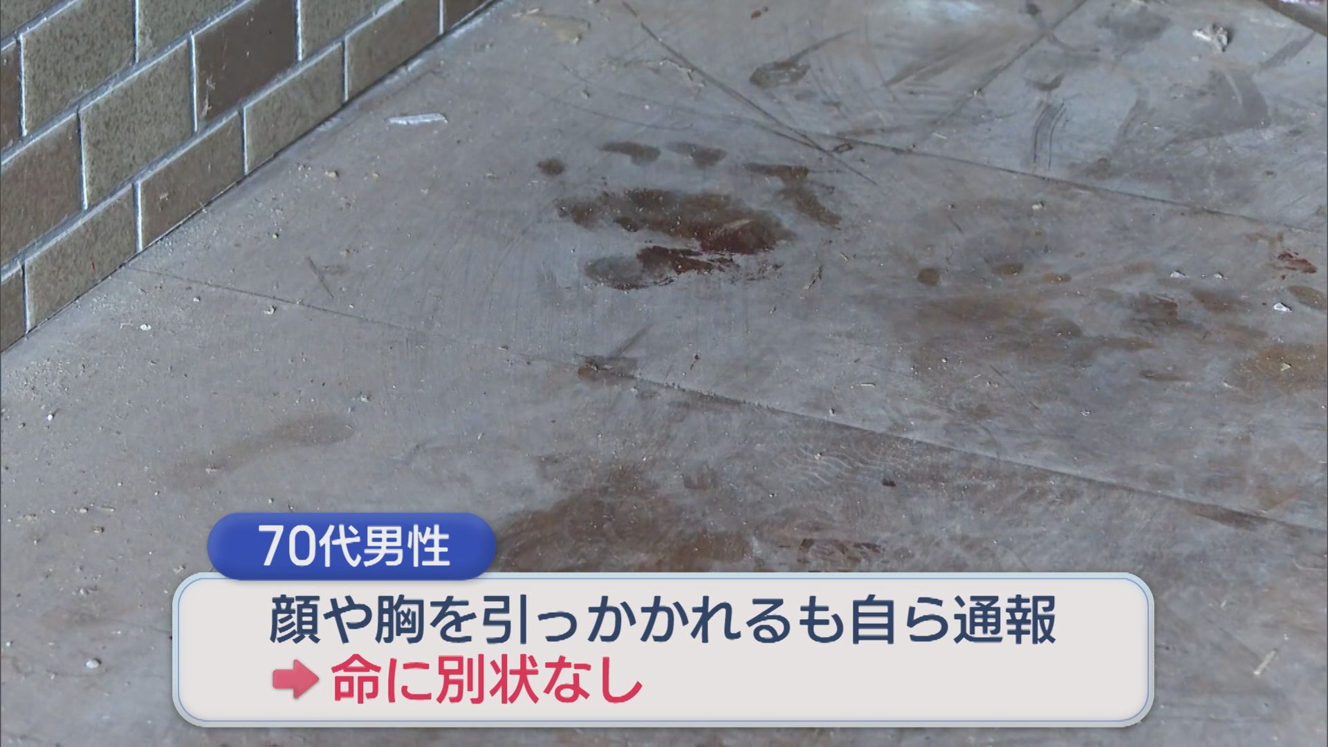 深夜に玄関を開けたらクマが…70代男性が顔や胸を引っかかれケガ【新潟･長岡市】 2025年10月11日(土)