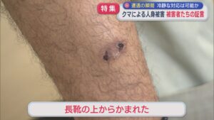 【特集】クマに襲われた被害者たちの証言：県内の人身被害は過去最多のペース【新潟】 2025年11月12日(水)