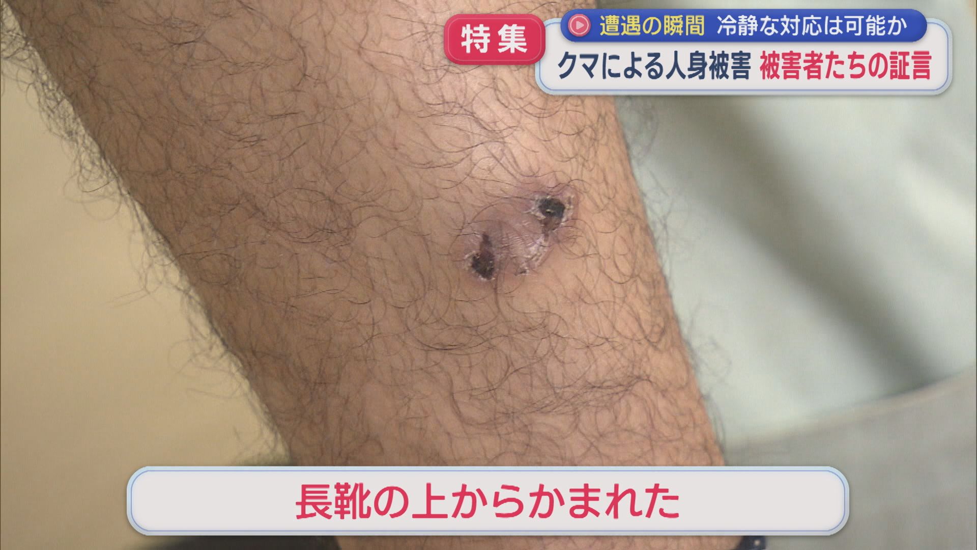 【特集】クマに襲われた被害者たちの証言：県内の人身被害は過去最多のペース【新潟】