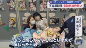 18トリソミー・医療的ケア児 写真展「命の輝きを見て涙が･･･」参加する家族の思い【新潟】 2026年09月07日(月)